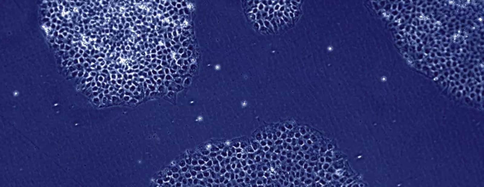 human-cells-under-microscope-hero