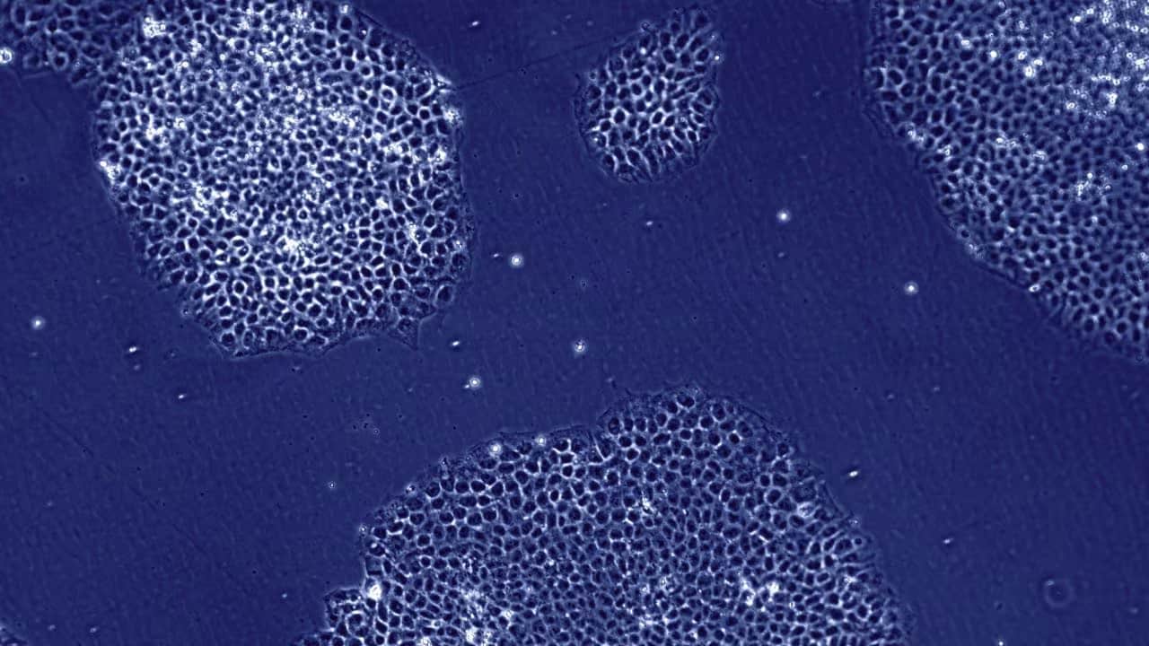 human-cells-under-microscope-hero